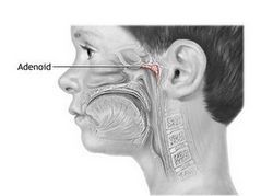 Аденоиды нормальных размеров