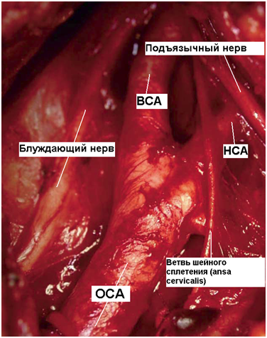 Анатомические взаимоотношения между черепными нервами и сосудами шеи.