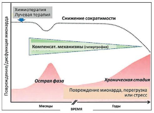 Развитие кардиотоксичности при лечении рака