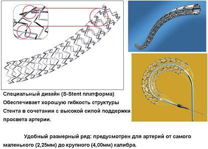 Стент BIOMATRIX