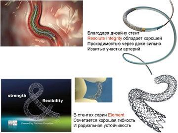 Стенты 3-го поколения