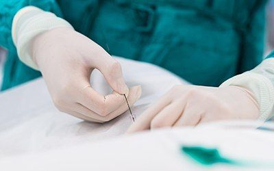 Ангиопластика и стентирование артерий