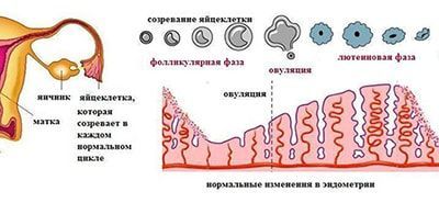 Бесплодие эндокринное