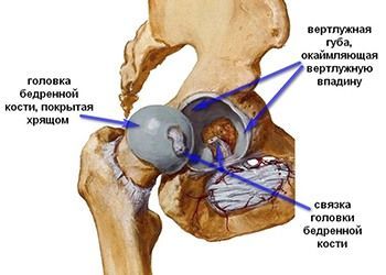 Дисплазия тазобедренных суставов