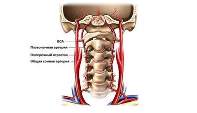 Дуплексное сканирование сонных и позвоночных артерий