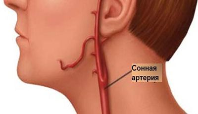 Где Находится Сонная Артерия У Человека Фото