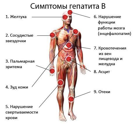 Симптомы гепатита B