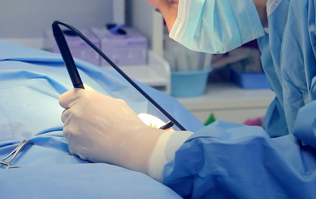 Коагуляция методом радиохирургии при лечении заболеваний шейки матки