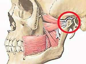 КТ височно-нижнечелюстного сустава