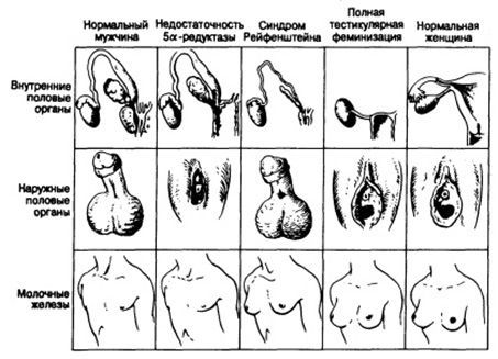 Адреногенитальный синдром