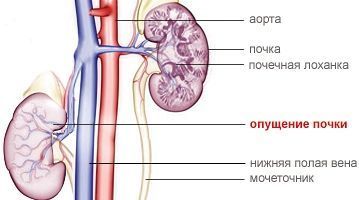 Где Находятся Почки Фото Со Спины Женщины