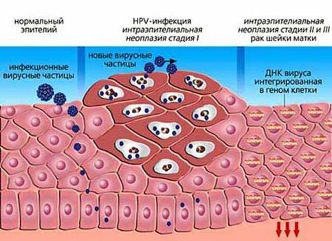 Стадии развития инфекции