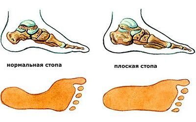 ÐÐ»Ð¾ÑÐºÐ¾ÑÑÐ¾Ð¿Ð¸Ðµ