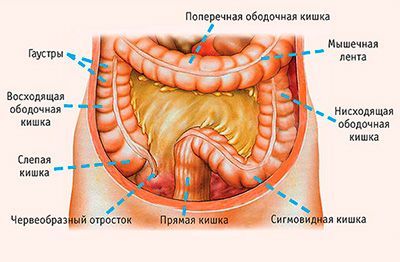 Рак ободочной кишки