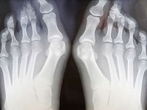 Рентгенография костей и суставов конечностей