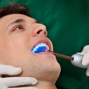 Снятие зубных отложений