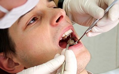 Удаление и лечение кисты зуба
