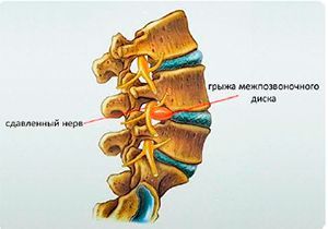 Операции при заболеваниях позвоночника