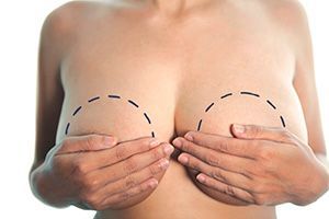 Гигантомастия в клинике ЦЭЛТ в Москве