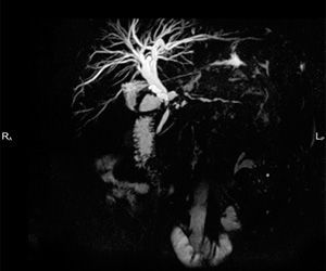 Магнитно-резонансная холангиография в клинике ЦЭЛТ в Москве