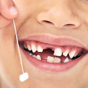 Удаление временного зуба (сложное) с анестезией в клинике ЦЭЛТ в Москве