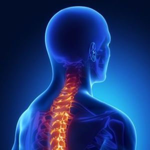 Спондилоартроз