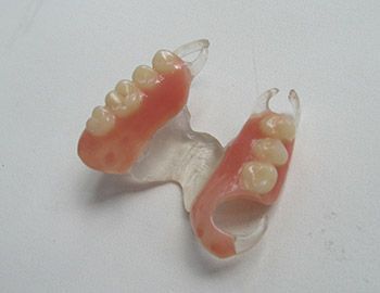 Коррекция съемной ортопедической конструкции (замена пластиковой матрицы в бюгельном протезе) в клинике ЦЭЛТ в Москве