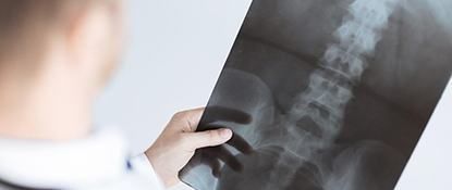 Рентгенография поясничного отдела позвоночника в клинике ЦЭЛТ в Москве
