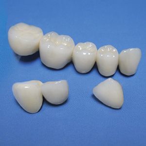 Изготовление коронки металлокерамической (на драг. сплаве (без стоимости метала) в клинике ЦЭЛТ в Москве