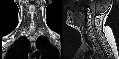 Магнитно-резонансная томография в клинике ЦЭЛТ в Москве