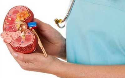 Опухоли лоханки и мочеточника