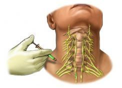 Симпатическая блокада в клинике ЦЭЛТ в Москве
