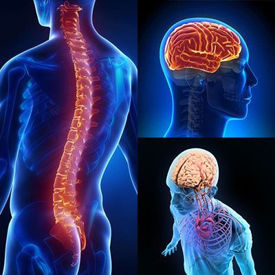 МРТ ЦНС в клинике ЦЭЛТ в Москве