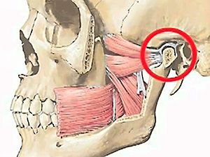КТ челюсти в клинике ЦЭЛТ в Москве