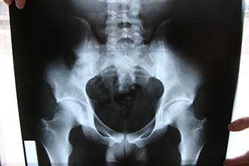 Рентгенография крестца в клинике ЦЭЛТ в Москве