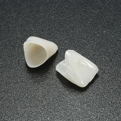 Восстановление зуба коронкой (временная фиксация коронки, изготовленной в другой клинике) в клинике ЦЭЛТ в Москве