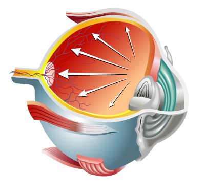 Антиглаукоматозная операция при первичной глаукоме 1 стадии заболевания (I категория сложности) в клинике ЦЭЛТ в Москве