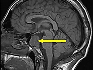 Компьютерная томография гипофиза в клинике ЦЭЛТ в Москве