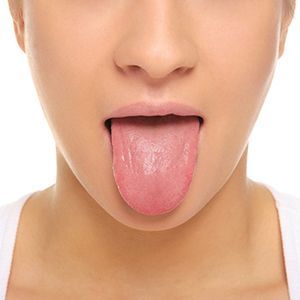 Пластика уздечки языка в клинике ЦЭЛТ в Москве