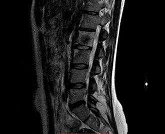 Рентгенография шейного отдела позвоночника в клинике ЦЭЛТ в Москве