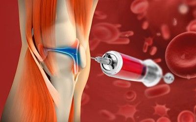 PRP-терапия в клинике ЦЭЛТ в Москве
