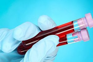 Использование специального расходного материала (шприц для АСР терапии) в клинике ЦЭЛТ в Москве