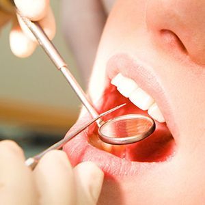 Композитный ретейнер с опорой в клинике ЦЭЛТ в Москве