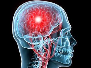 Ангионеврология