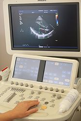 Дуплексное сканирование артерий и вен одной нижней конечности в клинике ЦЭЛТ в Москве