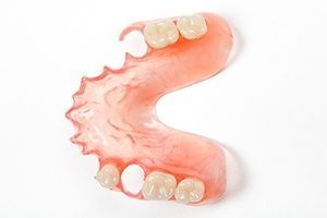 Протезы «Valplast»