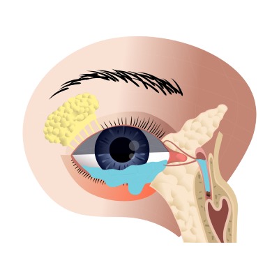 Дакриоцисториностомия (I категория сложности) в клинике ЦЭЛТ в Москве