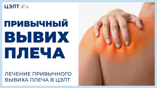 Привычный вывих плеча. Лечение привычного вывиха плеча в ЦЭЛТ.