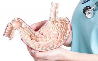 Опухоли желудка, органов забрюшинного пространства, почек, надпочечников, мягких тканей