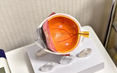 Удаление халязиона до 5 мм в клинике ЦЭЛТ в Москве